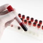 deficiência de vitamina b12 sintomas e tratamentos