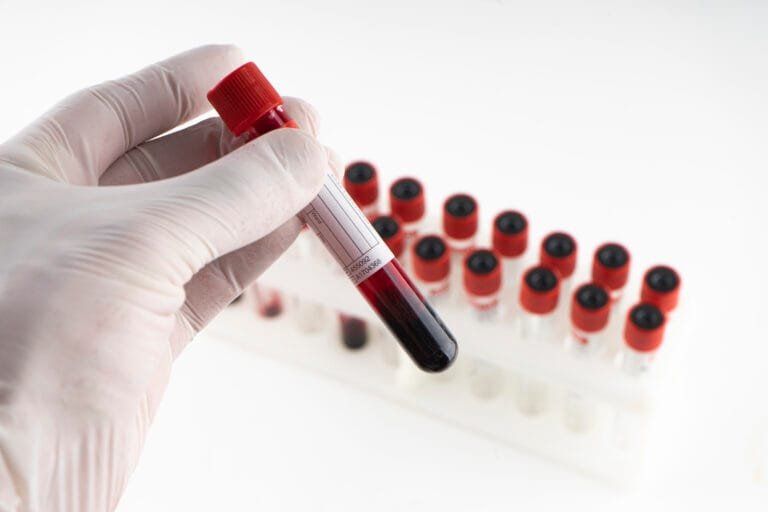 deficiência de vitamina b12 sintomas e tratamentos