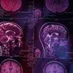 neuroinflamação sintomas