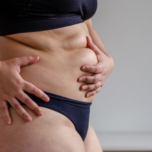 como perder peso só na barriga