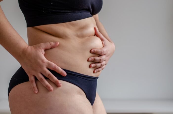 como perder peso só na barriga