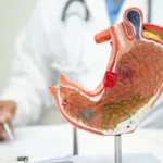 alt= benefícios da cirurgia bariátrica