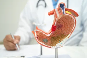 benefícios da cirurgia bariátrica
