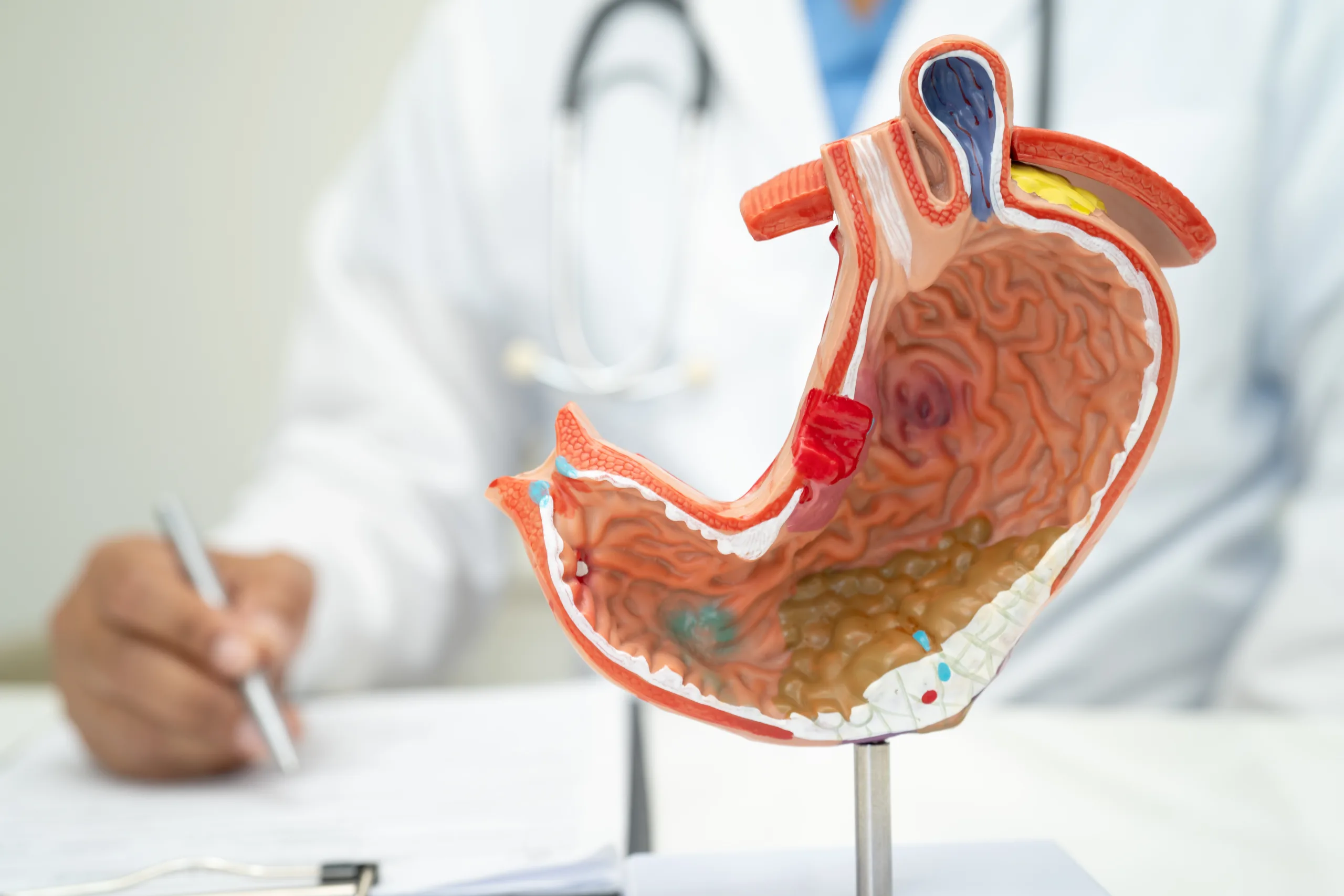 alt= benefícios da cirurgia bariátrica