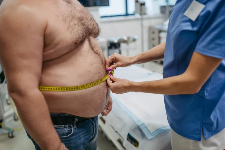 benefícios da cirurgia bariátrica